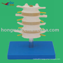 Vivid PVC Normal Lumbar Model (4 pcs)